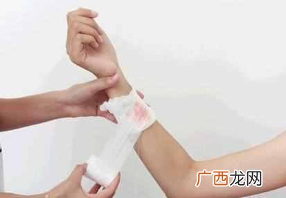 被狗狗咬了多久时间内必须打针（被狗狗咬到后