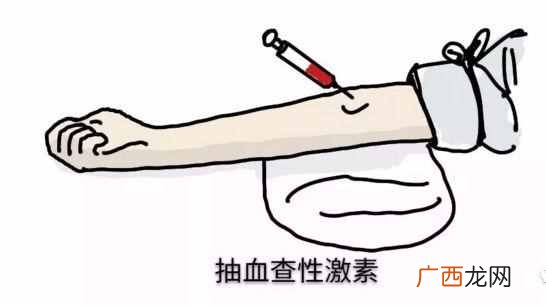 性激素六项什么时候检查合适？性激素六项的最佳检查时间？