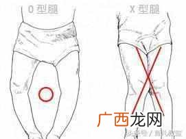 宝宝腿不直怎么办？可能是缺钙，补充营养是关