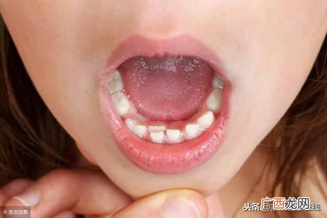 牙龈出血怎么办？牙龈出血的原因及快速止血的