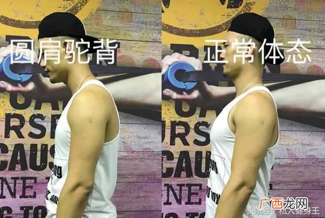 成人驼背了怎么办？健身达人教你改善驼背（一