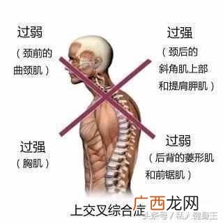 成人驼背了怎么办？健身达人教你改善驼背（一
