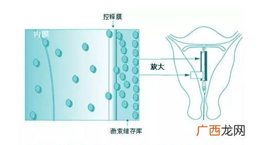上曼月乐环月经量减少是怎么回事