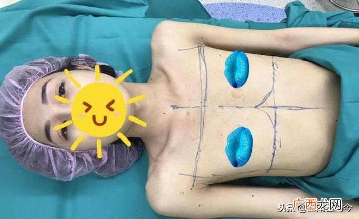 以为自己是女人的男人，为实现做回女人的梦想
