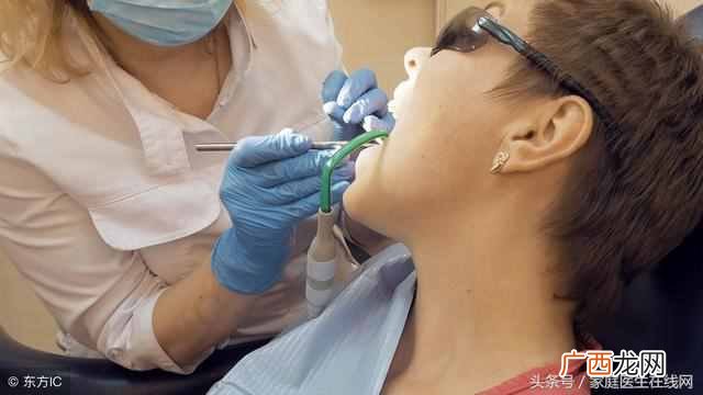 4个小方法 牙结石怎么去除的小妙招