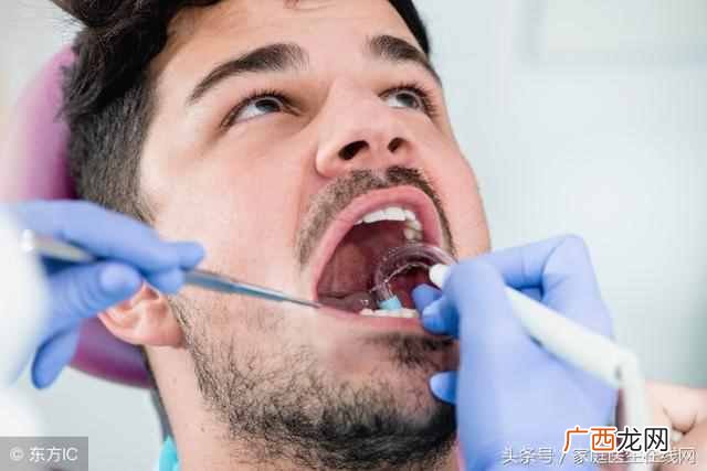 4个小方法 牙结石怎么去除的小妙招