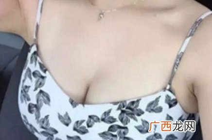 备孕期间怎么丰胸 备孕期间可以丰胸吗