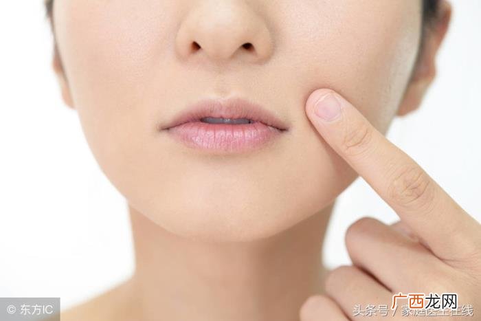 鼻子容易脱皮是什么原因 鼻子脱皮是什么原因