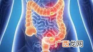 大便“前干后稀”是怎么了?哪里有问题?是我们不能忽视的问题