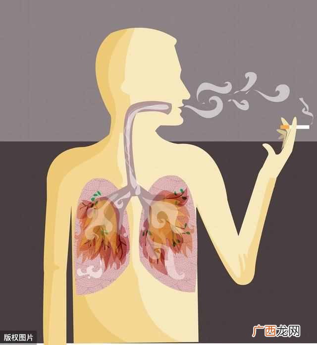 有人一直吸烟，肺干干净净，有人从不吸烟，却查出肺癌？