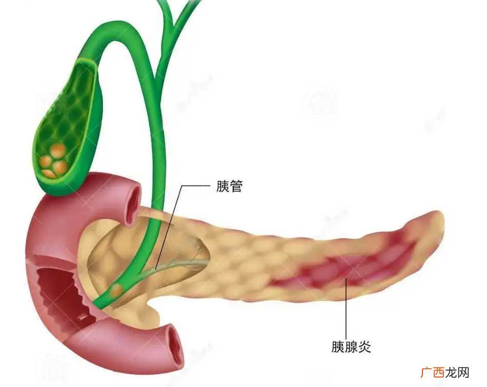 胰腺在人体的哪个部位图解，腰腹后壁1-2腰椎平面就是胃后边