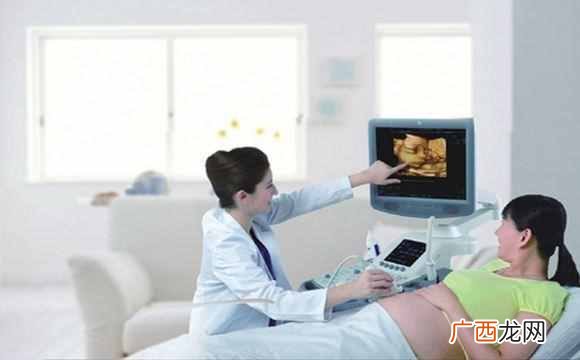 四维彩超最佳时间是几周（为什么要照四维彩超