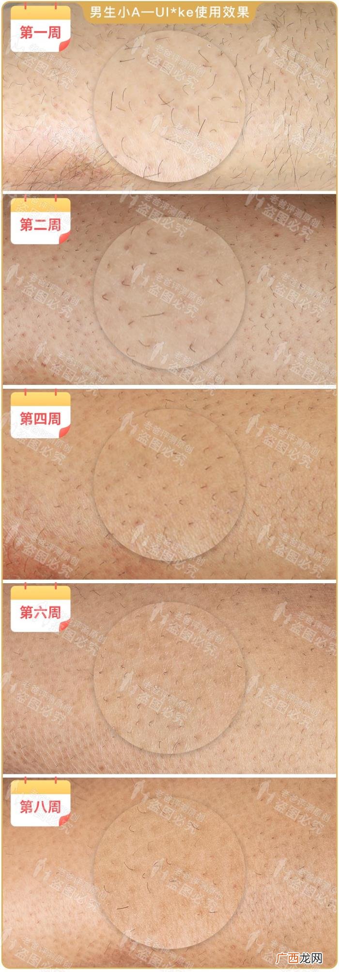 真人真腿实测4款热销脱毛仪 光子脱毛效果