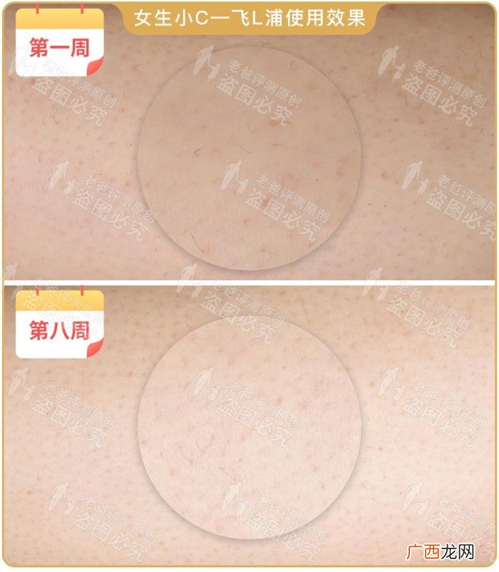 真人真腿实测4款热销脱毛仪 光子脱毛效果