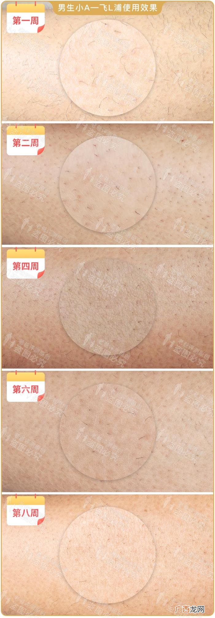 真人真腿实测4款热销脱毛仪 光子脱毛效果