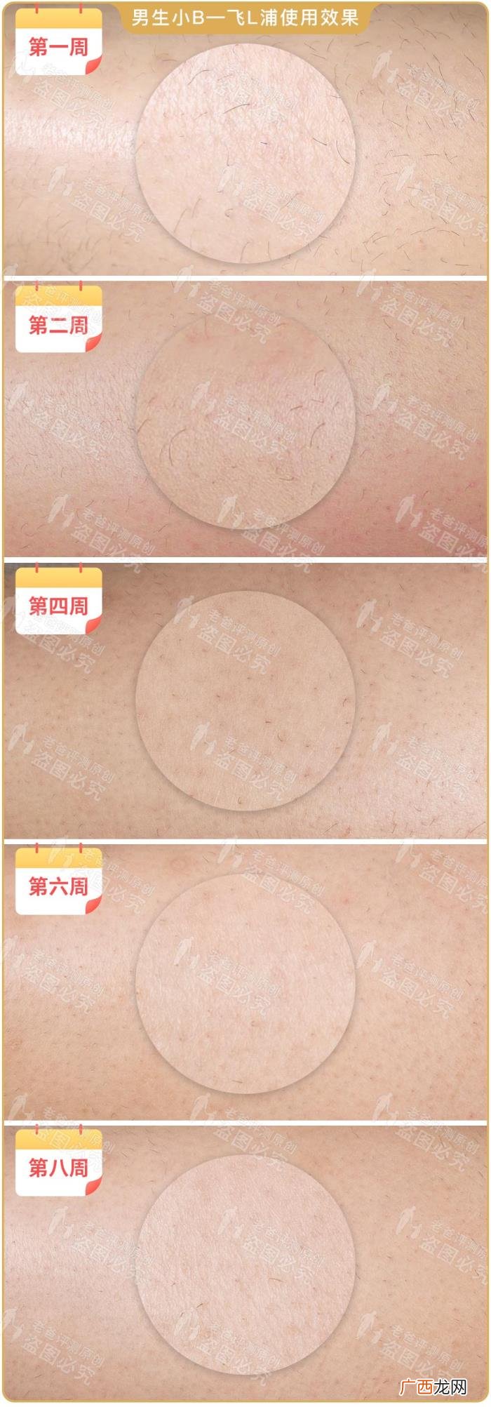 真人真腿实测4款热销脱毛仪 光子脱毛效果
