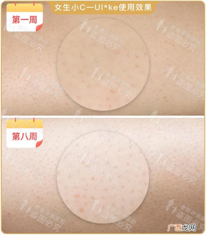 真人真腿实测4款热销脱毛仪 光子脱毛效果
