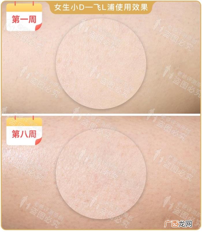 真人真腿实测4款热销脱毛仪 光子脱毛效果