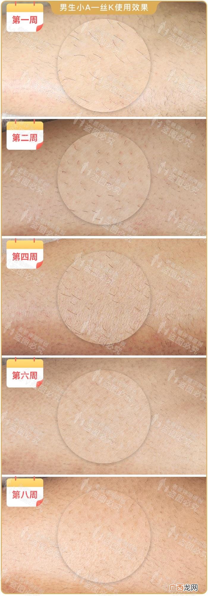 真人真腿实测4款热销脱毛仪 光子脱毛效果