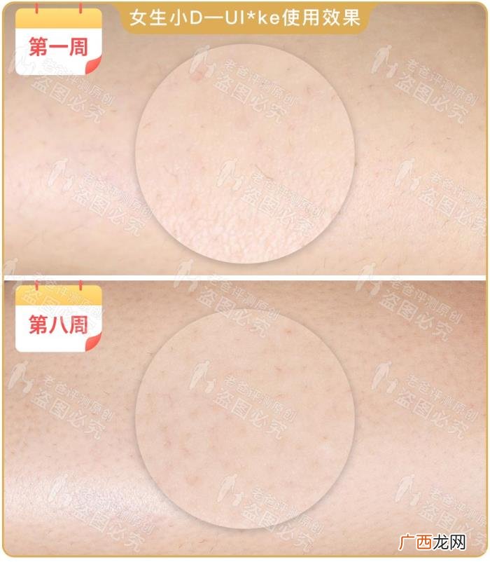 真人真腿实测4款热销脱毛仪 光子脱毛效果