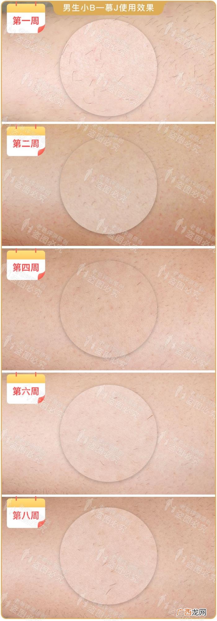 真人真腿实测4款热销脱毛仪 光子脱毛效果