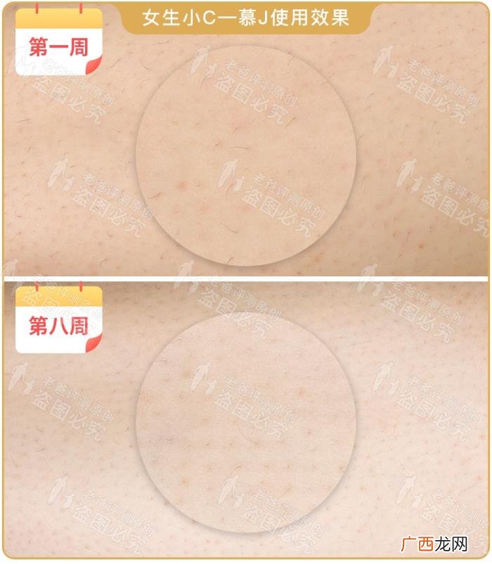 真人真腿实测4款热销脱毛仪 光子脱毛效果