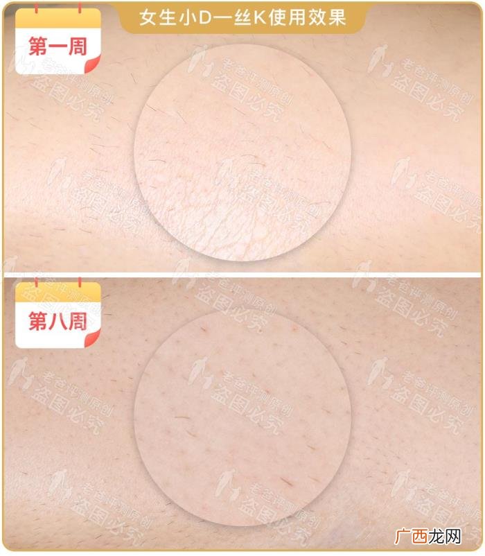 真人真腿实测4款热销脱毛仪 光子脱毛效果
