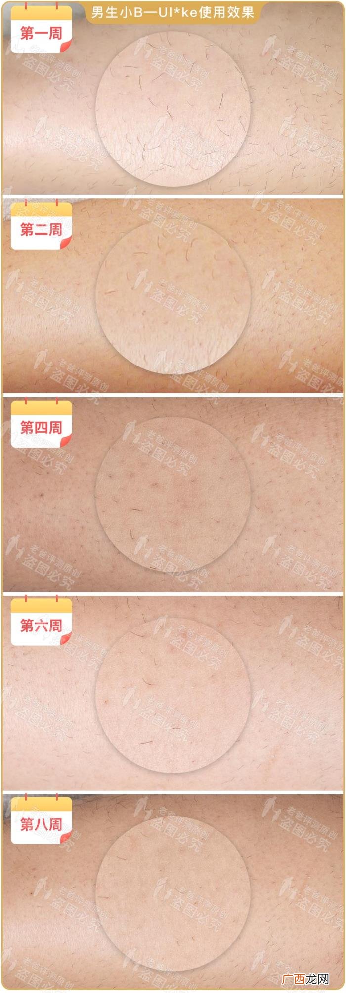真人真腿实测4款热销脱毛仪 光子脱毛效果