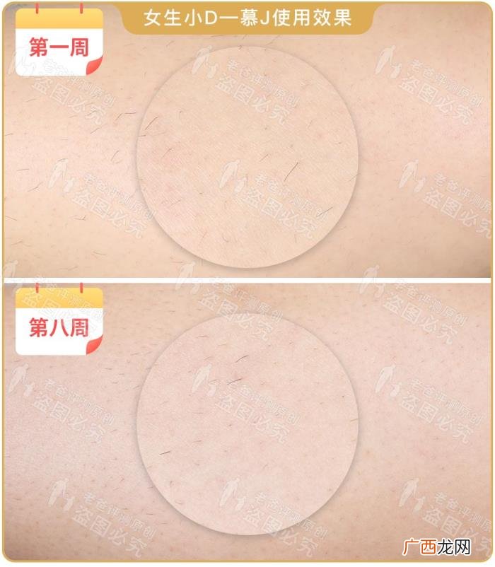 真人真腿实测4款热销脱毛仪 光子脱毛效果