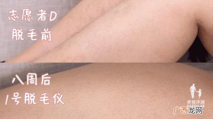 真人真腿实测4款热销脱毛仪 光子脱毛效果