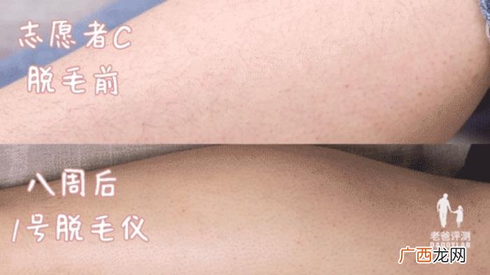 真人真腿实测4款热销脱毛仪 光子脱毛效果
