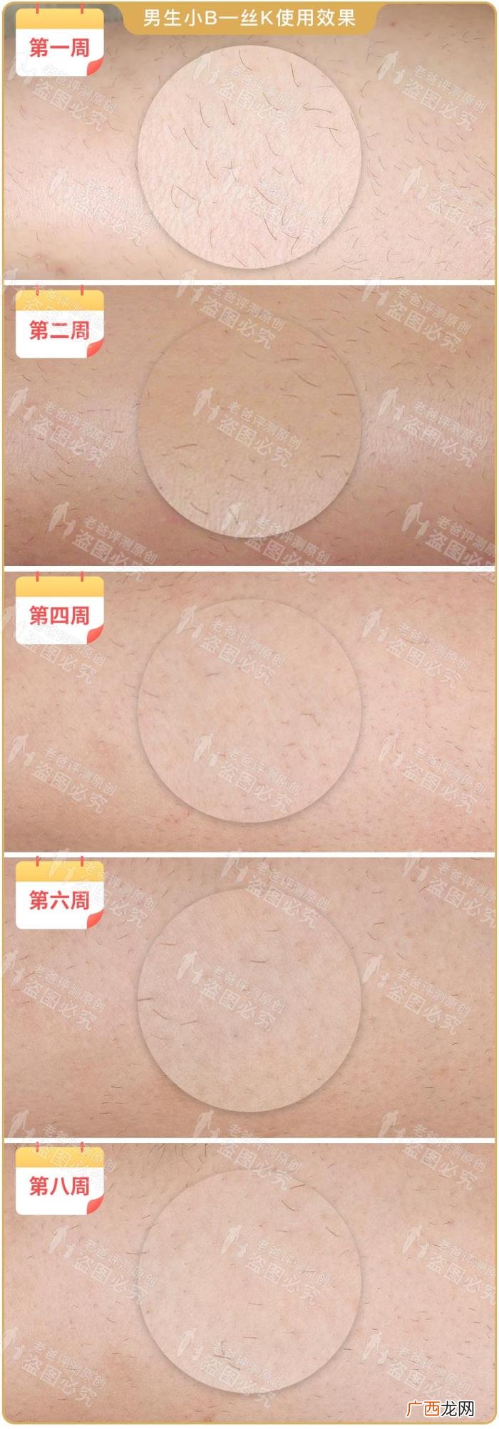 真人真腿实测4款热销脱毛仪 光子脱毛效果