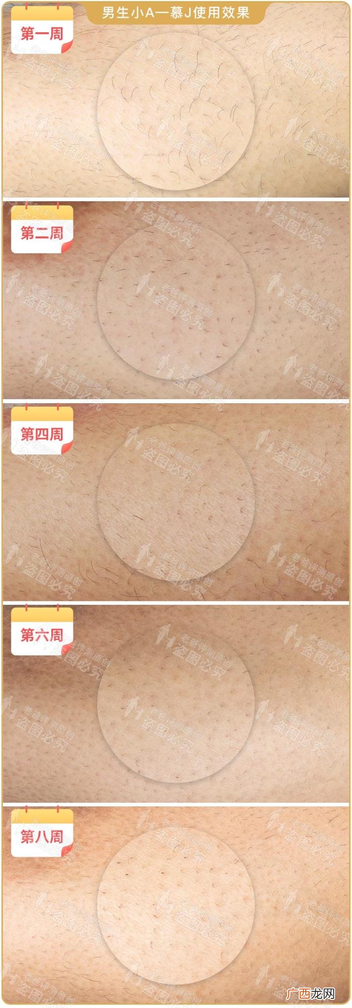 真人真腿实测4款热销脱毛仪 光子脱毛效果