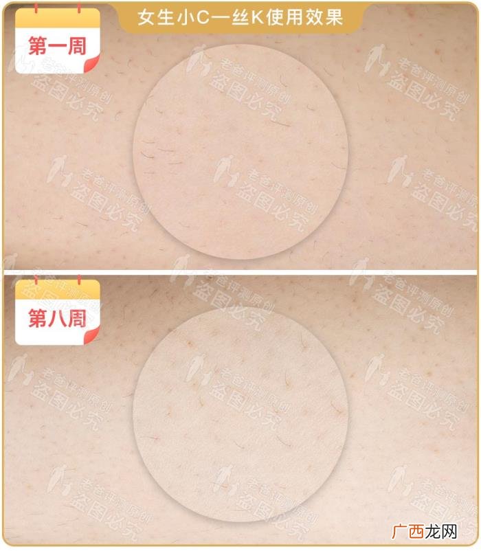 真人真腿实测4款热销脱毛仪 光子脱毛效果