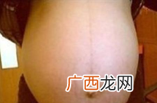 二胎生男生女怎样判断最准确