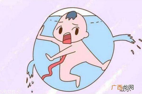 怀孕期女性胎膜早破怎么办