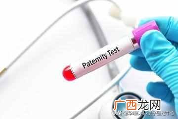 亲子鉴定21个位点分析 dna亲子鉴定价格
