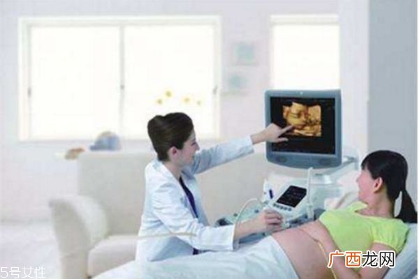 孕妇什么时候做四维彩超最好