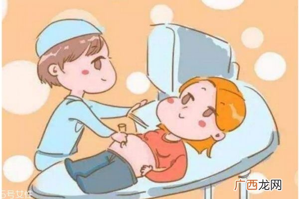 孕妇什么时候做四维彩超最好