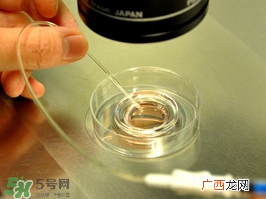 试管婴儿的具体步骤医院做试管婴儿步骤