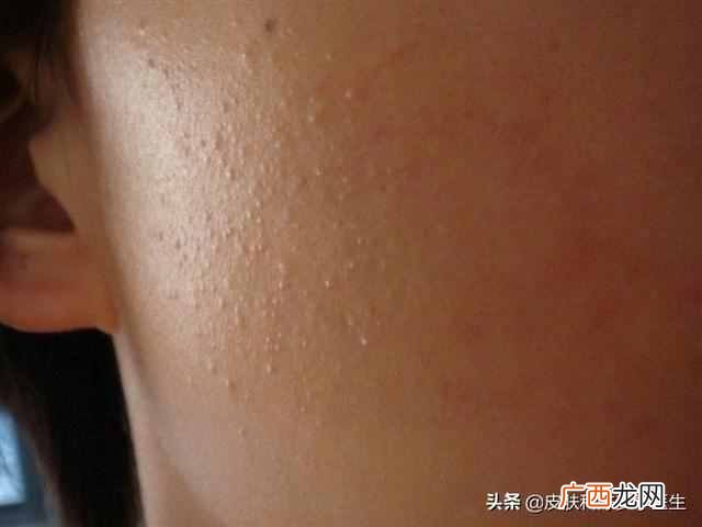 上海治疗青春痘医院排名，上海治疗青春痘医院