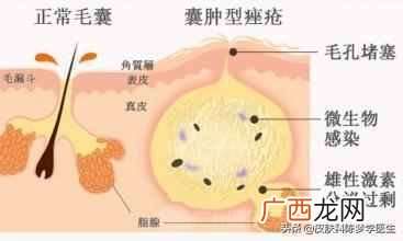 上海治疗青春痘医院排名，上海治疗青春痘医院