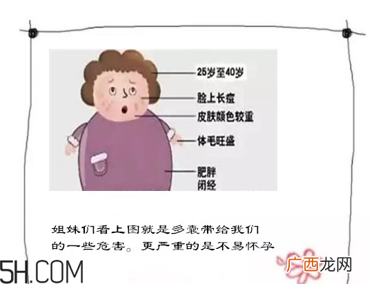 多囊卵巢生不了？多囊卵巢怀孕要看准时间