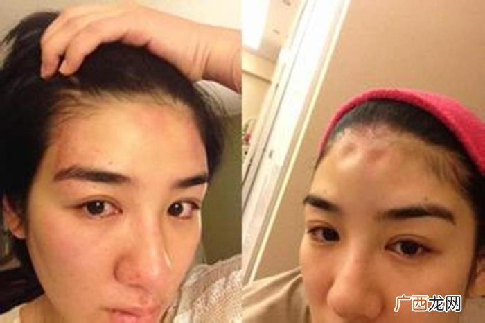 黄奕痛诉遭前夫孕期家暴 黄奕离婚了吗
