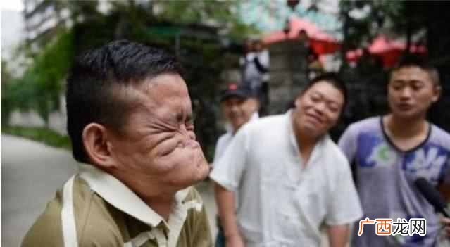 浅谈世界上最丑的人及配图 世界上最丑的人