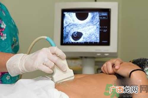 孕妇做b超要空腹吗？孕妇做b超要不要空腹？
