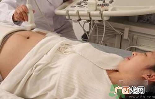 孕妇做b超要空腹吗？孕妇做b超要不要空腹？
