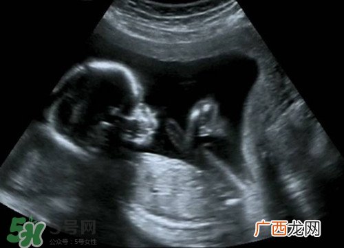 怀孕多久可以做b超?怀孕做b超对胎儿有影响吗