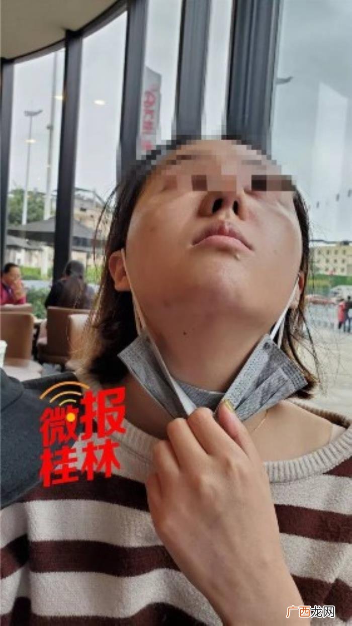 眼整容要多少钱，女子花3.7万元整容