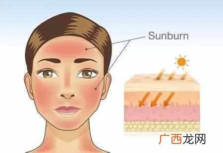 上海哪里看痘痘最好，上海治痘痘医院排名！